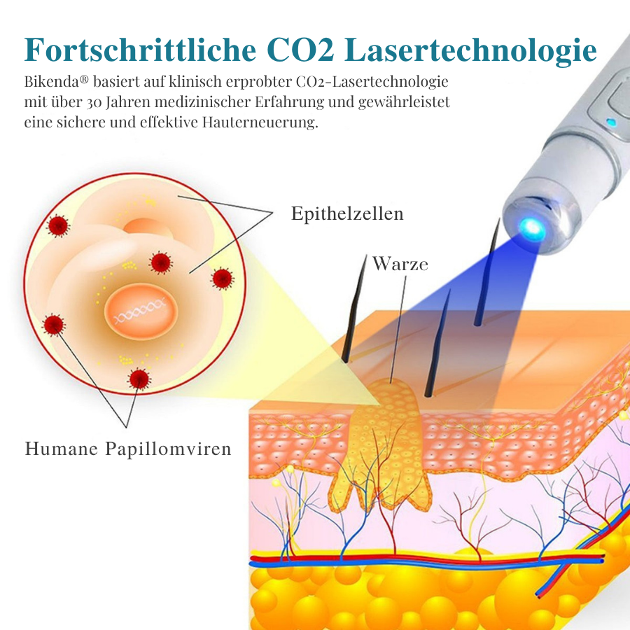 Bikenda® LumeSkin Muttermal und Warze Entfernung Laserstif