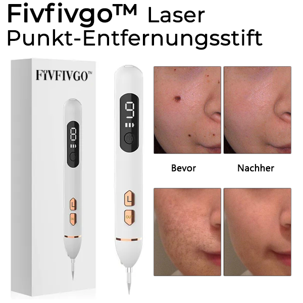 Fivfivgo™ Laser-Punkt-Entfernungsstift