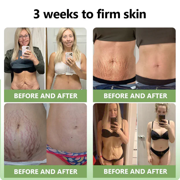 Fivfivgo™ Luxurious Collagen Peptide Firming Cream