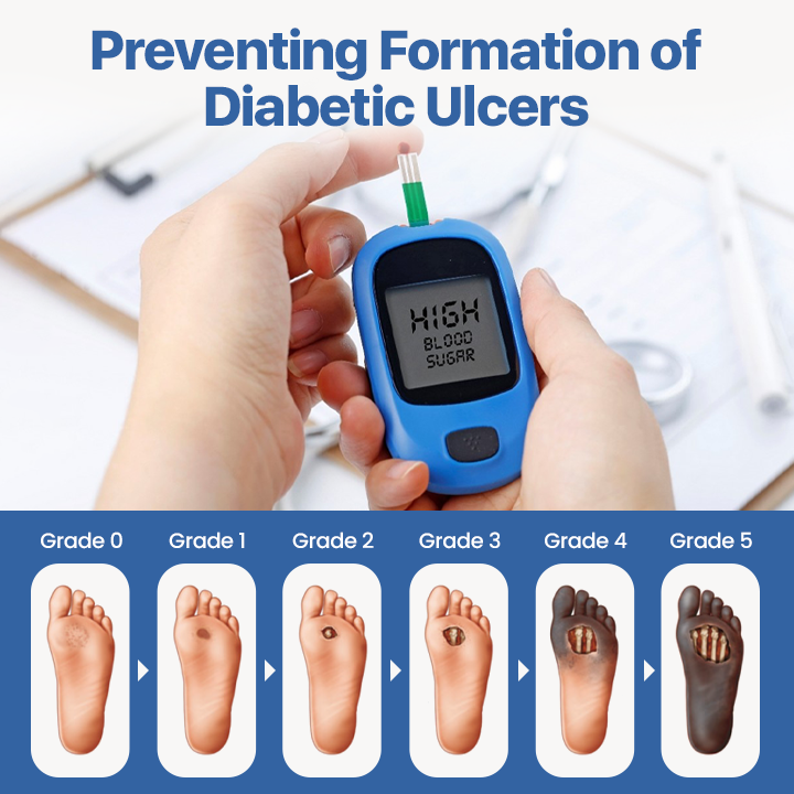 Cvreoz® VitaGluco Diabetes Treatment Cream