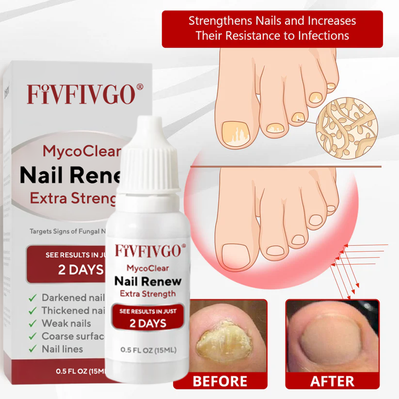 Fivfivgo® MycoClear Nail Renew Extra Strength