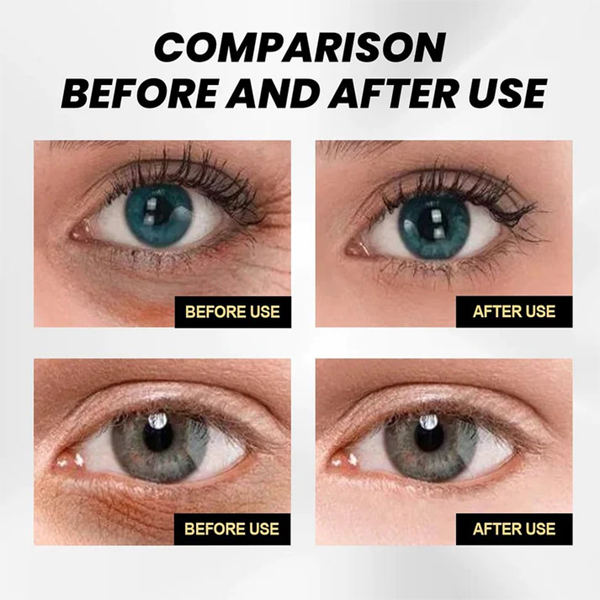 Fivfivgo™ Snabb uppstramande anti-aging ögonkräm