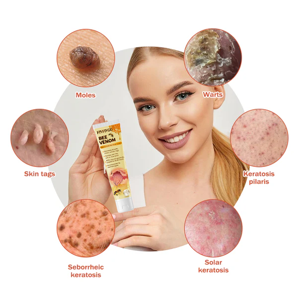 Fivfivgo™ Bee Venom Mole and Wart Cream