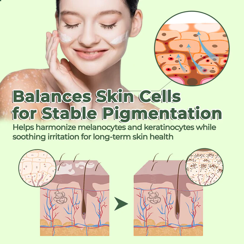 Fivfivgo® Vitiligo Treatment Ointment