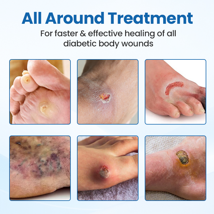 CZTICLE® DiabeHeal Skin Recovery Band