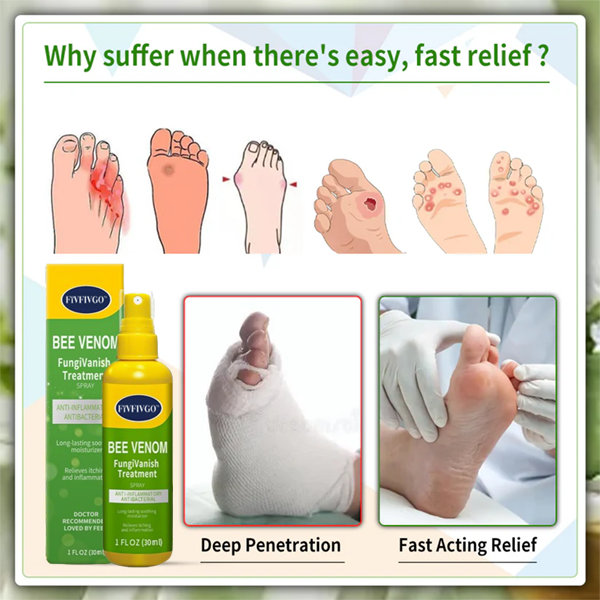 Fivfivgo™ BeeVenom FungiVanish-Behandlungsspray👨‍⚕️ (Fördert die Nagelregeneration, beseitigt wirksam Nagelpilz, Fußpilz und Fußgeschwüre)