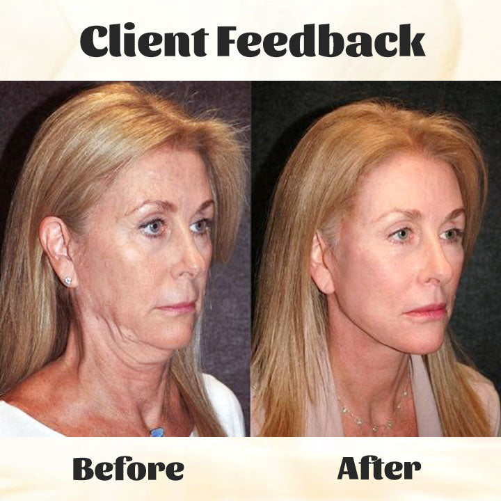 Fivfivgo™ RevTime NMN Essence anti-âge