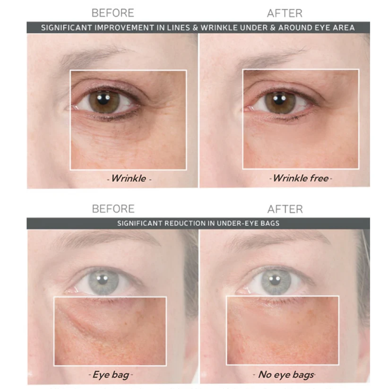 Fivfivgo™ Instant Eye Wrinkle Tightening Cream