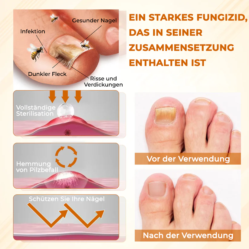 Fivfivgo® Fungiclear Bienen Therapie Nagelspray