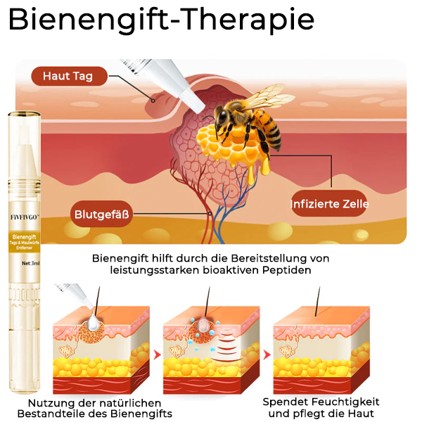 Fivfivgo™ Bienengift Tags & Maulwürfe Entferner