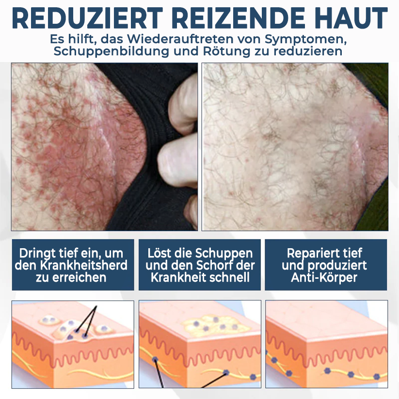 Fivfivgo® ManGuard HPV WART-Heilcreme