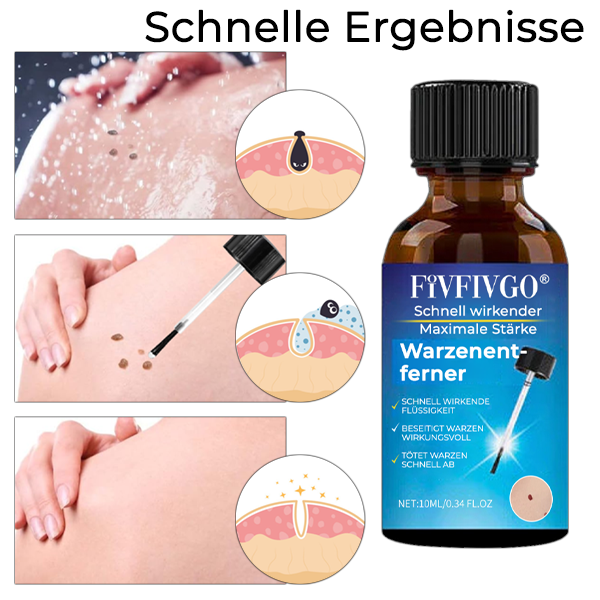 Fivfivgo® Schnell wirkender Maximale Stärke Warzenentferner
