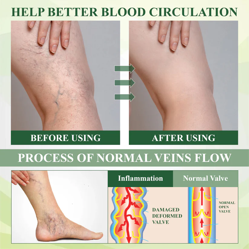 Fivfivgo® EdemaFree Flow Drain Massage Cream
