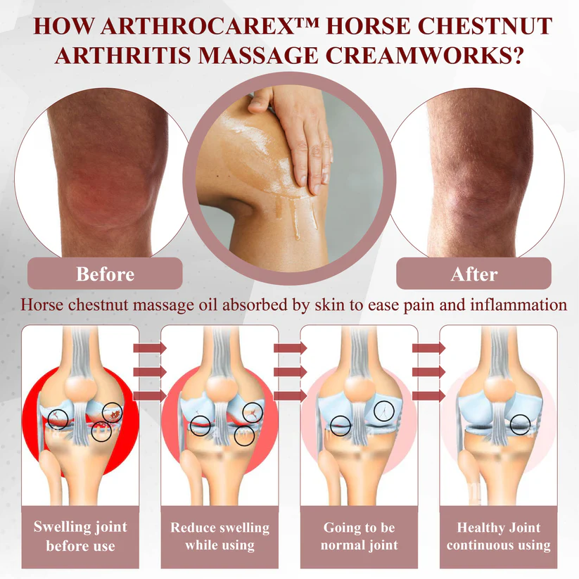 Fivfivgo™ Rosskastanie Arthritis-Massagecreme