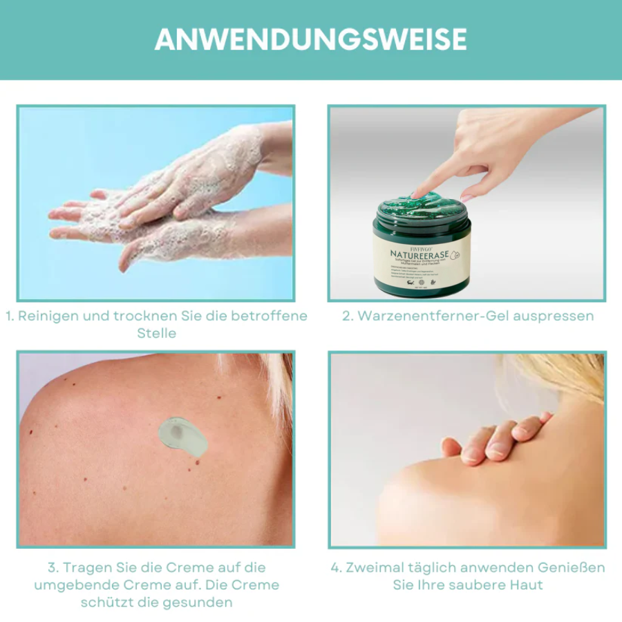 ✅ Offizieller Laden: Fivfivgo® NatureErase Sofortiges Gel zur Entfernung von Muttermalen und Flecken