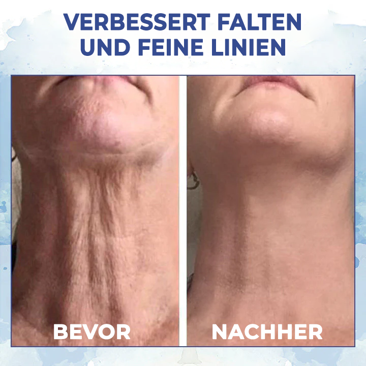 Fivfivgo™ LuxeLift Hautstraffende Jugendbutter