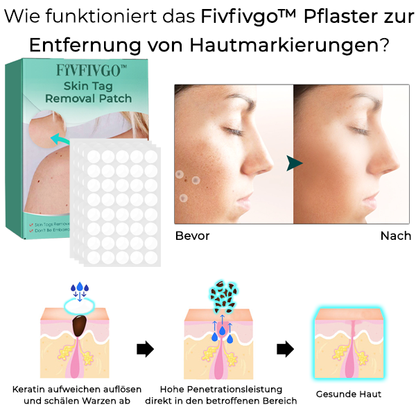 Fivfivgo™ Pflaster zur Entfernung von Hautmarkierungen
