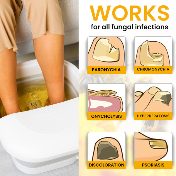 Fivfivgo™ Bee Venom Nail Fungus Treatment Soak