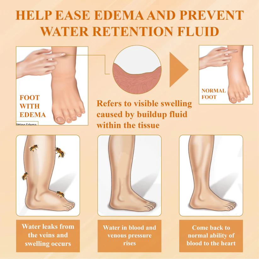 Fivfivgo™ EdemaSlim Care Detox Body Cream