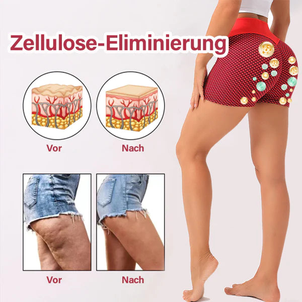 Fivfivgo™ Turmalin Ion Atmungsaktiv Lift&Shape Kurz