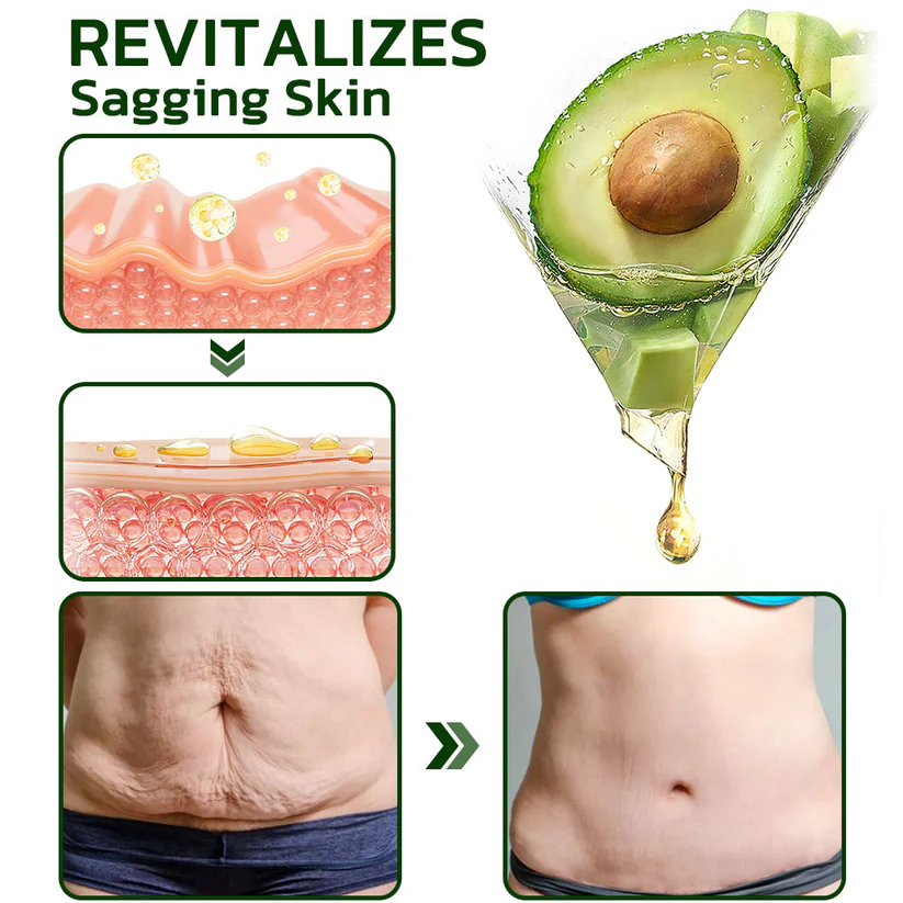 Fivfivgo™ Avocado Straffendes und Falten reduzierendes Körperlotion-Peeling (🇨🇦CDA empfohlen)