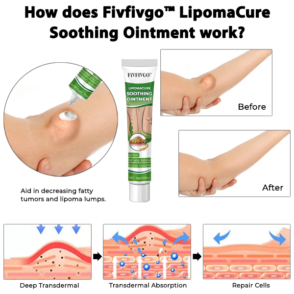 Fivfivgo™ LipomaCure Soothing Ointment