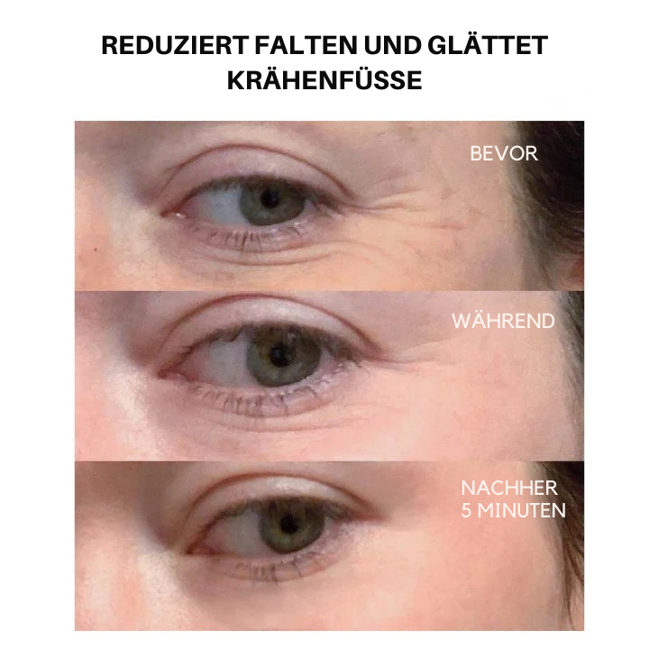 Fivfivgo™ Klinische SkinCare Sofortiger Augenstraffer