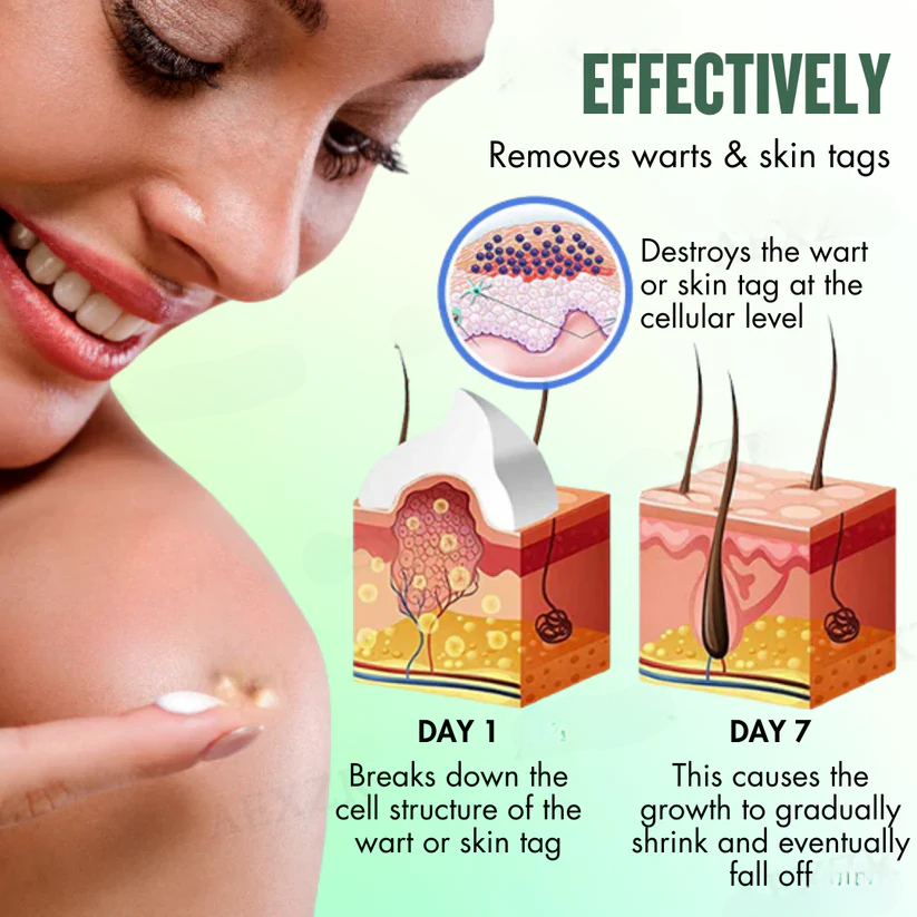 Fivfivgo™ Instant Blemish Removal Cream