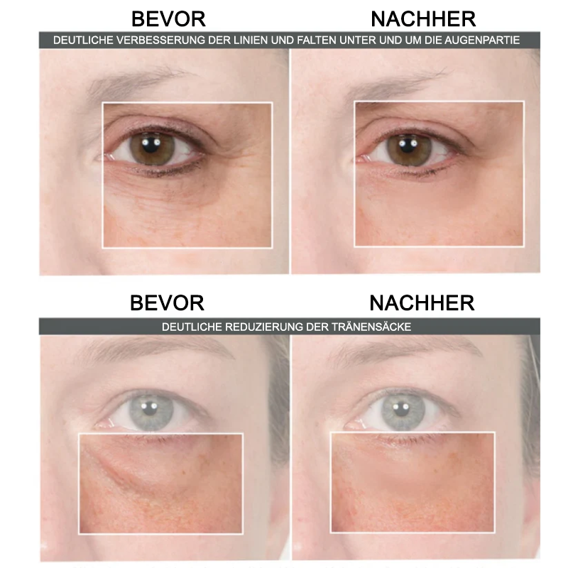 Fivfivgo™ Creme zur sofortigen Straffung der Augenfalten