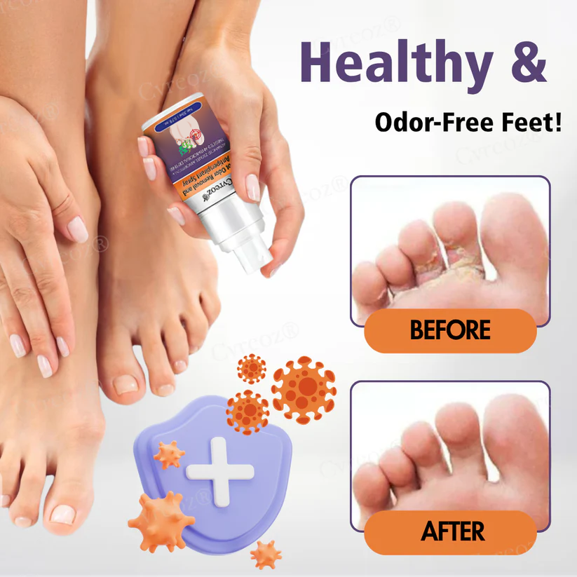 Cvreoz® FreshStep Foot Odor and Nail Fungus Spray