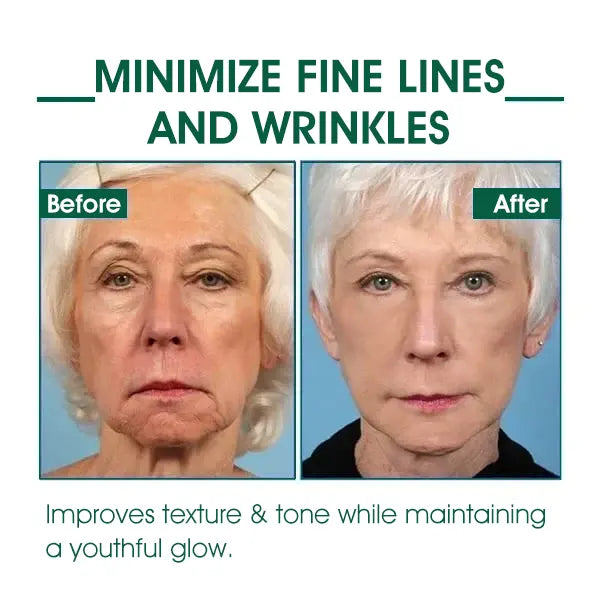 Fivfivgo™ Botox Facial Serum