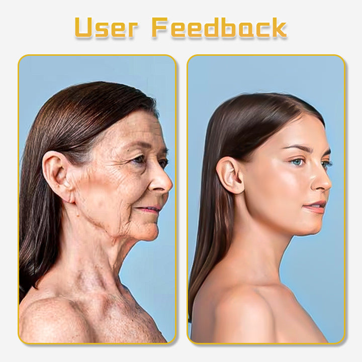 Fivfivgo™ UltraRenew Appareil de lifting à ultrasons Dispositif