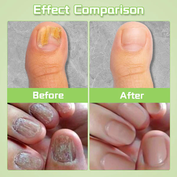 Fivfivgo™ Nail Repair Serum