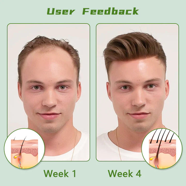 Fivfivgo™ Red Ginseng Hair Growth Spray