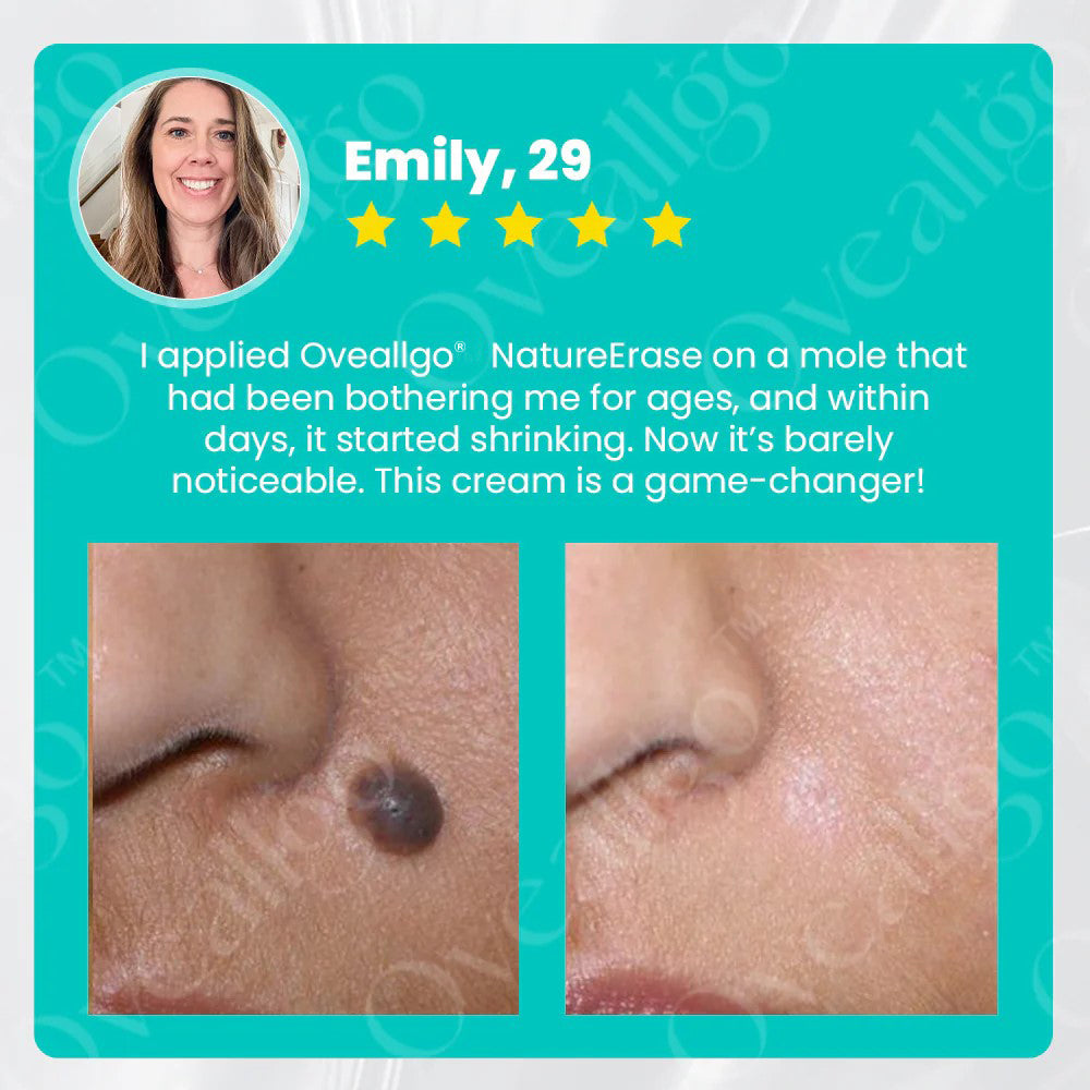 ✅ Official Store: Oveallgo® NatureErase Instant Alligator Oil Mole & Spot Removal Premium Gel