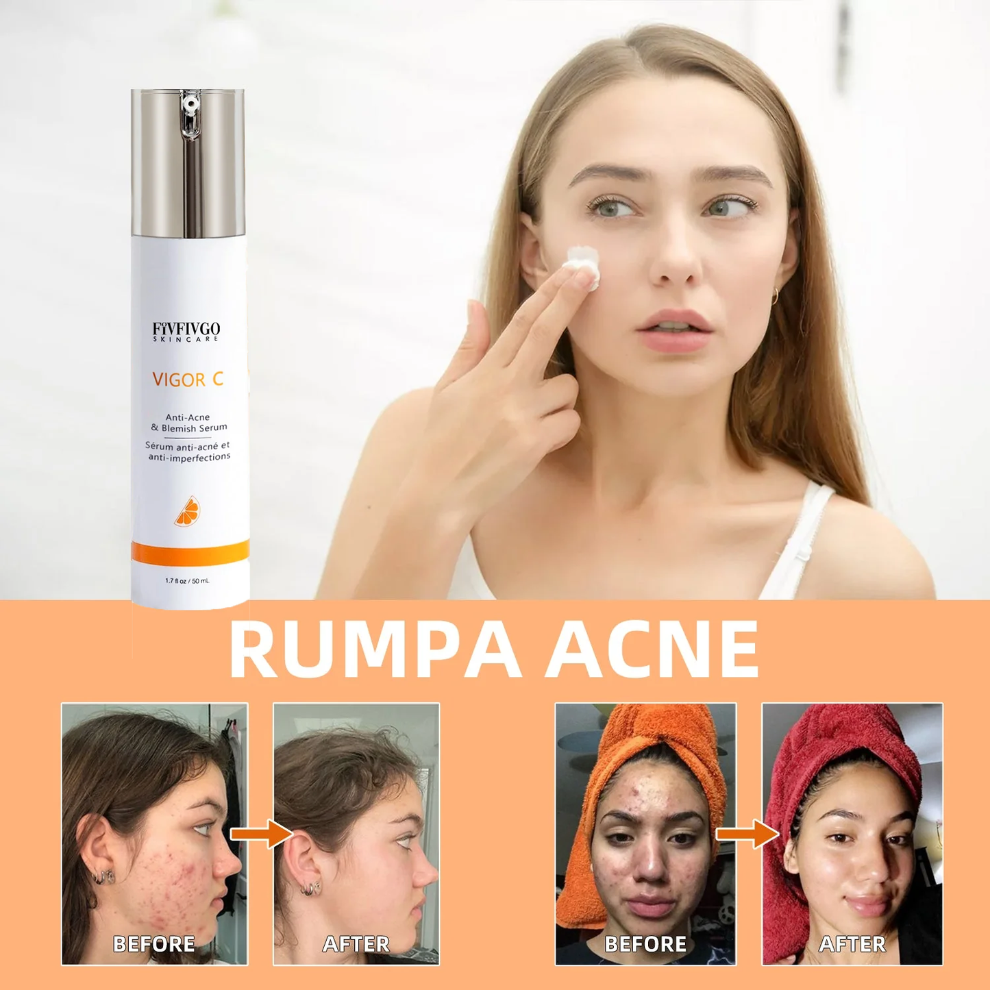 Fivfivgo™ VIGOR C Pakarat akne poistava seerumi (Akne & läiskät & Acanthosis Nigricans poisto)