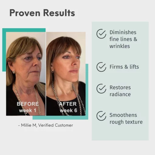 Fivfivgo™ Schweizisk grön Trippel polypeptid kaviar Uppstramande serum