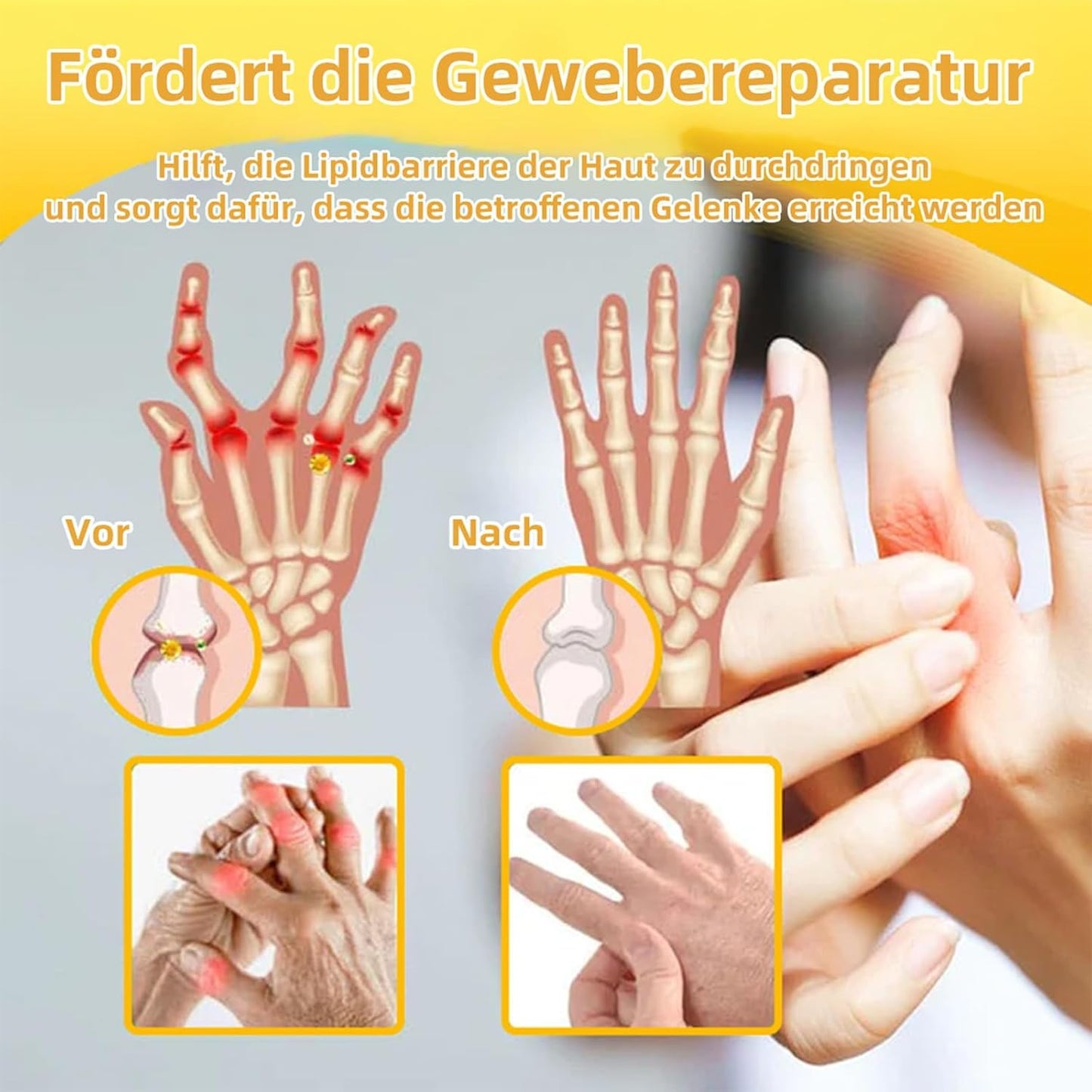 Fivfivgo™ Bienengift Fortgeschrittenes Gelenkt und Knochentherapie-Creme (Neuseeländischer Bienenextrakt - Spezialisiert auf orthopädische Erkrankungen und Arthritisschmerzen)