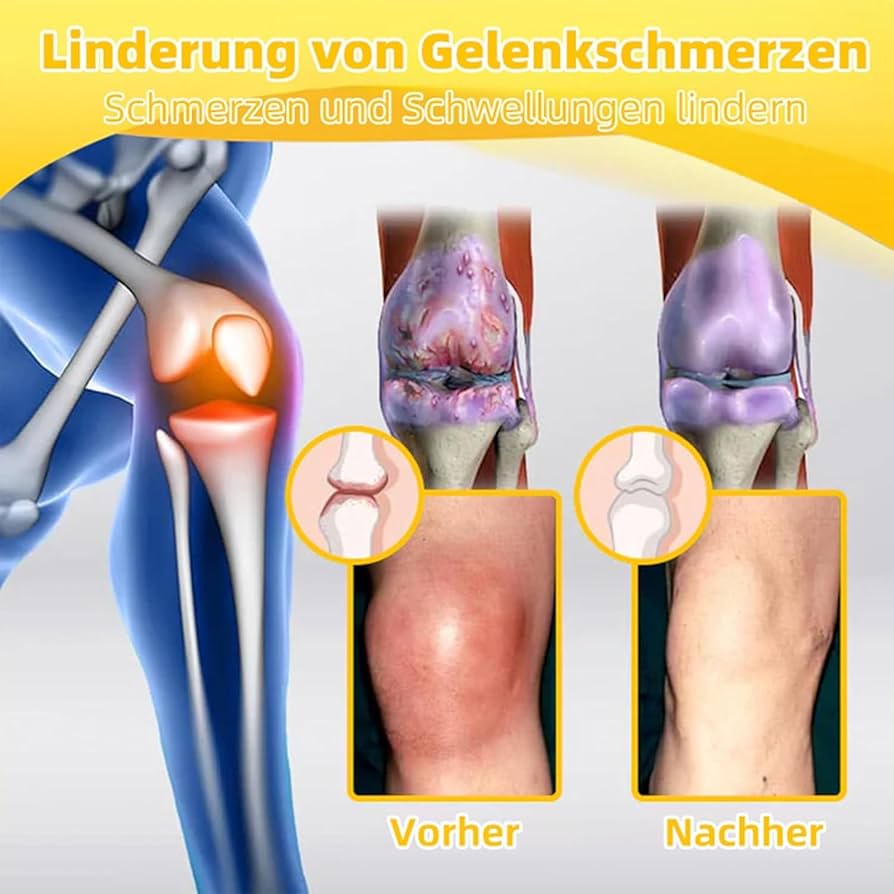 Fivfivgo™ Bienengift Fortgeschrittenes Gelenkt und Knochentherapie-Creme (Neuseeländischer Bienenextrakt - Spezialisiert auf orthopädische Erkrankungen und Arthritisschmerzen)