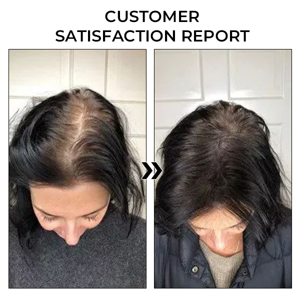 ✅Offizieller Shop: Fivfivgo™ BeeGrow Follicle Reviving Hair Essence 🌿 Anerkannt von AHLA & USP (klinisch erwiesen, um Haarfollikel zu aktivieren, die Gesundheit der Kopfhaut zu verbessern, Entzündungen zu reduzieren und Haarausfall zu verhindern)