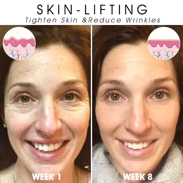 Fivfivgo™ Botox Facial Serum