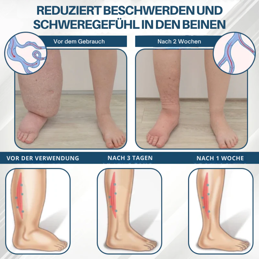 Fivfivgo® Schwarzkümmel Ödeme lindernde Kräutercreme