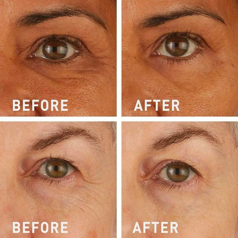 Fivfivgo™ Instant Eye Wrinkle Tightening Cream