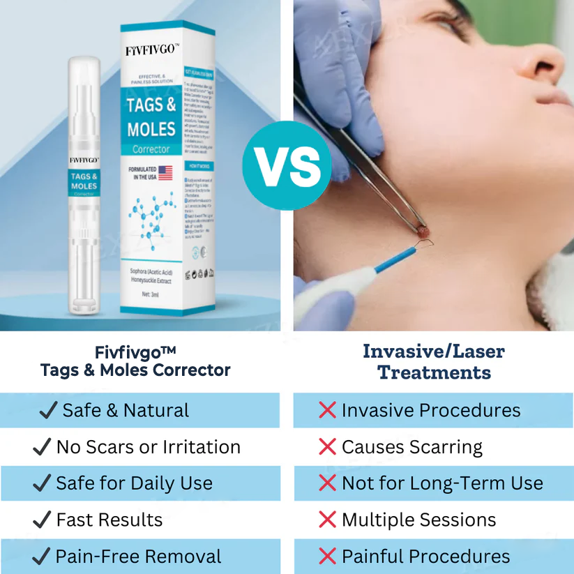 Fivfivgo™ Korrekturspray für Hautflecken und Muttermale