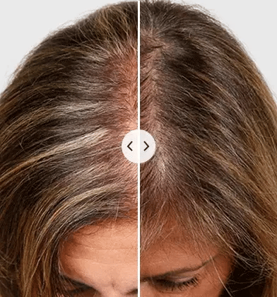 Fivfivgo™ Red Wave Laser Therapy Brosse pour la croissance des cheveux