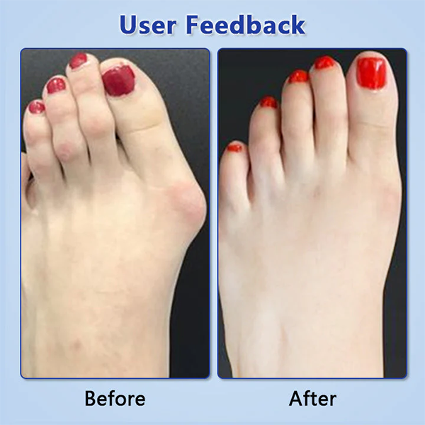 Fivfivgo™ JointRevive Bone Healing Gel Roll-On
