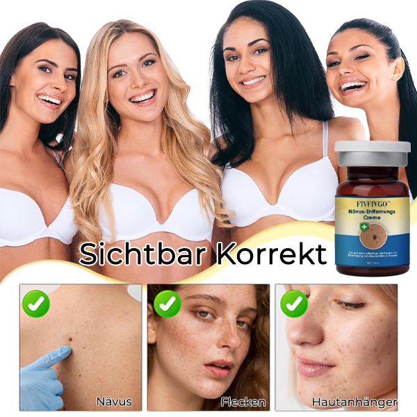 Fivfivgo™ Nävus-Entfernungs-Creme