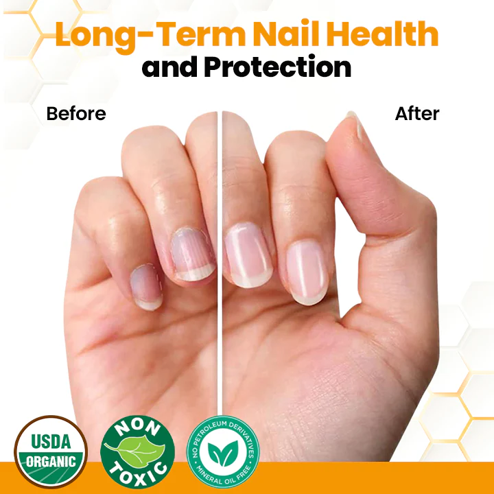 Fivfivgo™ BeeVenom Anti-Fungal Nail Renewal Oil
