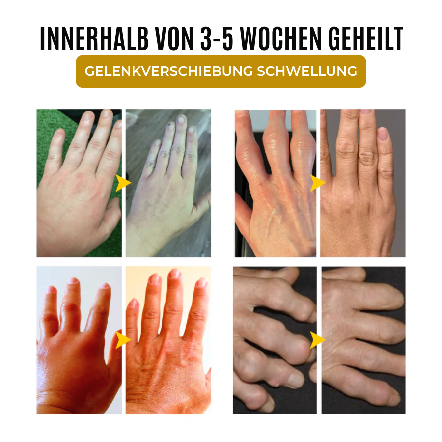 Fivfivgo® ArthroSoothe Kurkuma & Emuöl Schmerzlinderungs-Massagegel