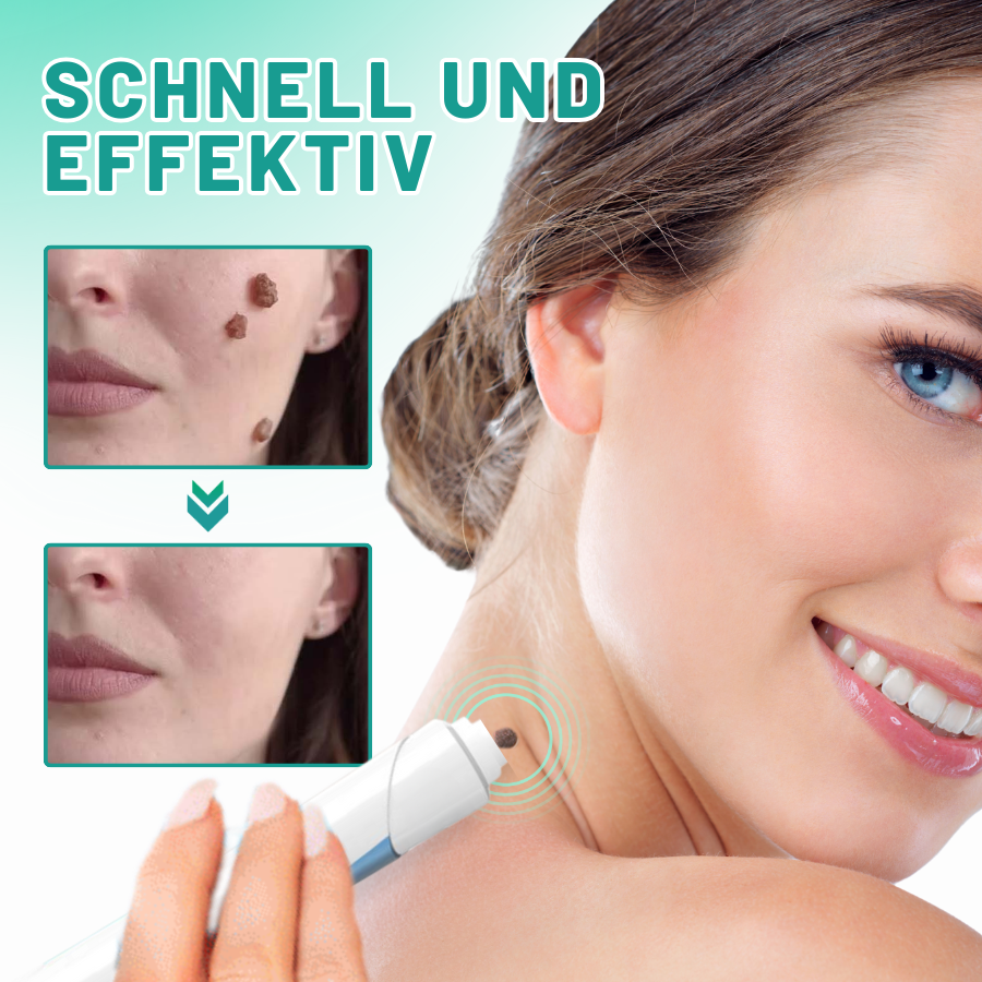 Fivfivgo™ 2-in1 Haut Tag Entfernung Kit